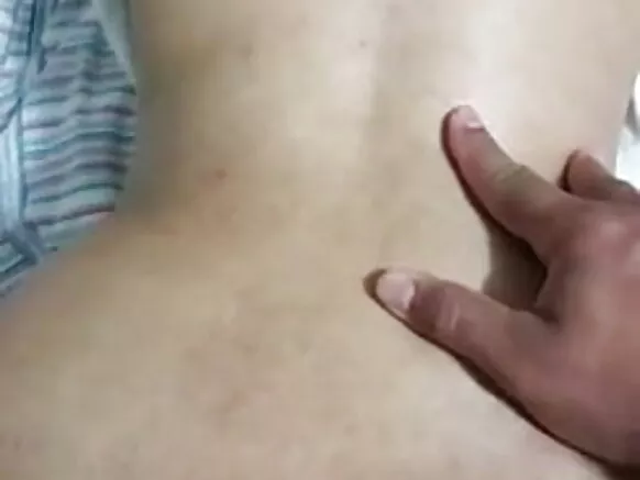 Mu anal prolapse muwoli, mbunda ya muwoli.